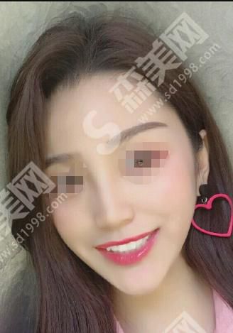 西安圣贝口腔医院做的拔智齿果如何？让你逃离智齿的折磨