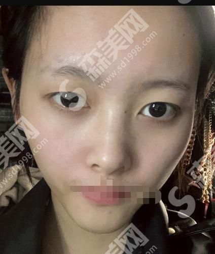 嘉兴荣军医院整形科的医生技术怎么样?附医师介绍及案例分享