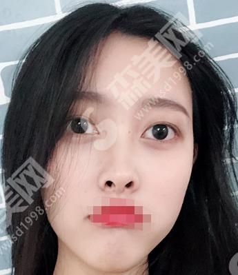 嘉兴荣军医院整形科的医生技术怎么样?附医师介绍及案例分享