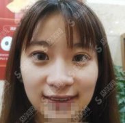 永川泰康拜博口腔医院收费合理吗？牙齿正畸案例分享及矫正价格查询