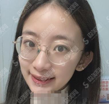 西京医院口腔科专家名单公布，个人简介＋案例展示