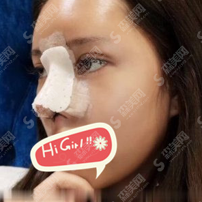 太原时光整形医院是正规医院吗?膨体隆鼻手术安排以后瞬间变成气质美女