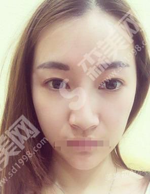 贵阳丽都整形医院的嫩肤果怎么样?靠谱吗?