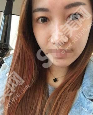 贵阳丽都整形医院的嫩肤果怎么样?靠谱吗?