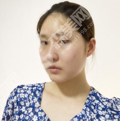 北京壹加壹整形医院怎么样?皮肤改善果怎么样?