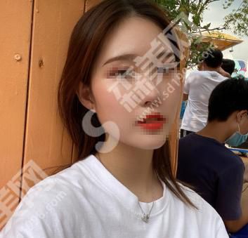 北京壹加壹整形医院怎么样?皮肤改善果怎么样?