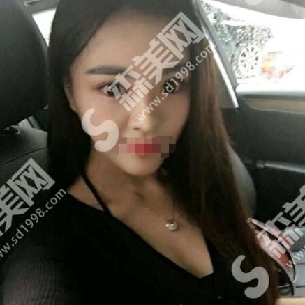 太原华美整形美容医院隆鼻果好不好?附医生介绍及案例分享