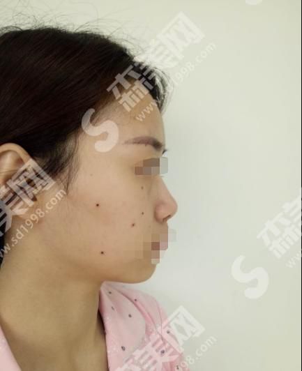 重庆玛恩皮肤医疗美容医院的地址在哪儿?内含医院介绍及鼻部整形案例分享