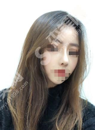 重庆玛恩皮肤医疗美容医院的地址在哪儿?内含医院介绍及鼻部整形案例分享