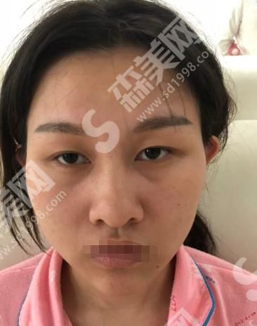 美联臣整形医院怎么样？附医师介绍及案例分享