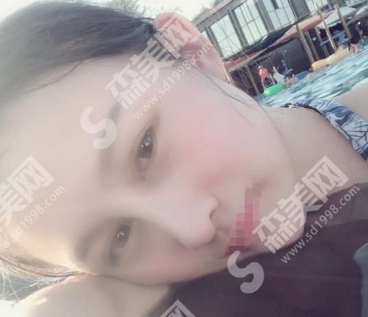 美联臣整形医院怎么样？附医师介绍及案例分享