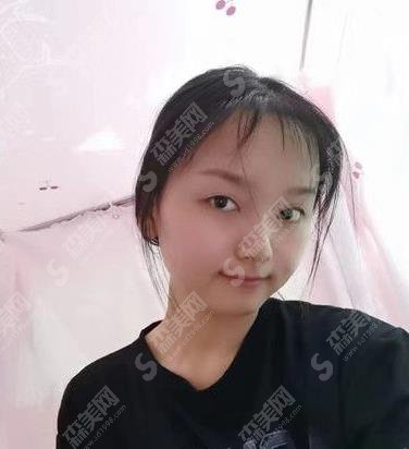 长沙美莱整形美容医院发际线种植案例分享及价格表不要错过!