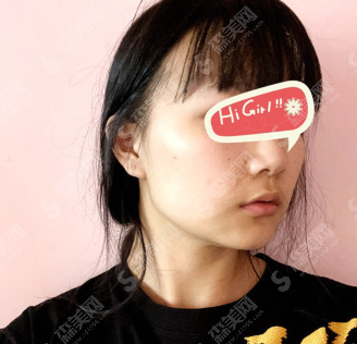 改脸型好的医院上海时光整形医院怎么样？改脸型的变化真是棒棒哒~