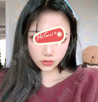 改脸型好的医院上海时光整形医院怎么样？改脸型的变化真是棒棒哒~