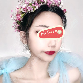 改脸型好的医院上海时光整形医院怎么样？改脸型的变化真是棒棒哒~