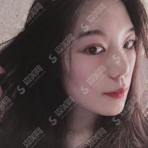 潍坊博雅整形医院像素激光祛斑的果对比图大分享,含较新的整形价目表