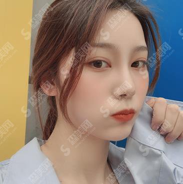 深圳薇姿医疗假体隆鼻怎么样?隆鼻案例揭晓及隆鼻价格查询