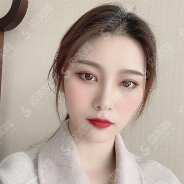 深圳薇姿医疗假体隆鼻怎么样?隆鼻案例揭晓及隆鼻价格查询