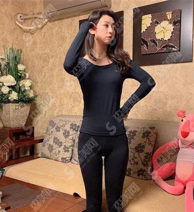 腰腹吸脂上海华美做的专业吗?价格查询及案例果对比照