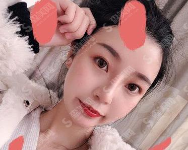 塘沽隆鼻开展的顺利吗?价格参考出炉及案例展示