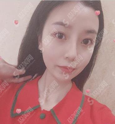 塘沽隆鼻开展的顺利吗?价格参考出炉及案例展示