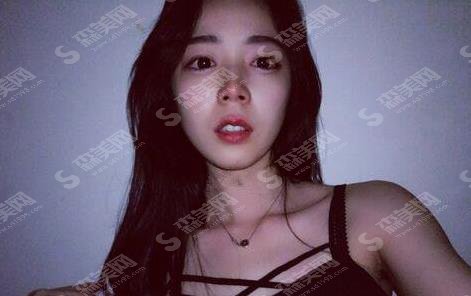 华西医院矫正牙齿费用,价格查询及牙齿矫正案例图片展示