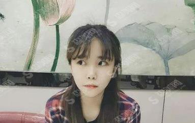 禾丽医美割双眼皮怎么样?果图一览+价格参考公布