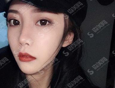 禾丽医美割双眼皮怎么样?果图一览+价格参考公布