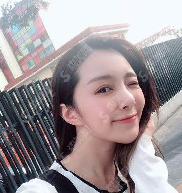 北京亚楠容悦眼部手术案例果图一览，2021较新眼部整形价格是多少钱？