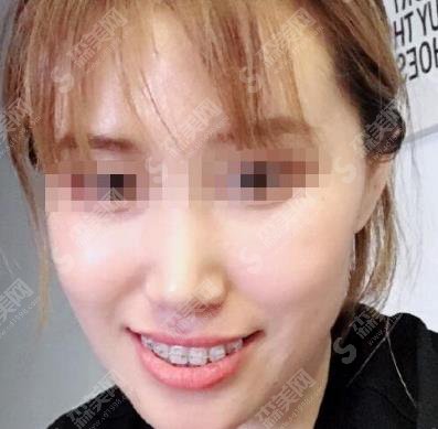 九院口腔科较好的医生房兵牙齿矫正专业吗？专家个人资料介绍，案例供参考