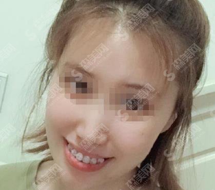 九院口腔科较好的医生房兵牙齿矫正专业吗？专家个人资料介绍，案例供参考