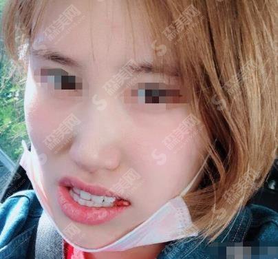 九院口腔科较好的医生房兵牙齿矫正专业吗？专家个人资料介绍，案例供参考