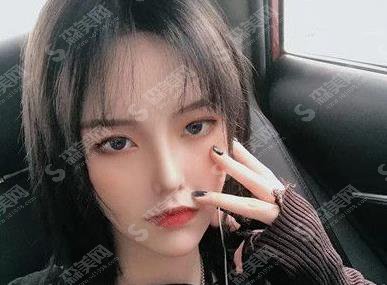 健威整形医院价格，隆鼻案例分享及价格收费参考