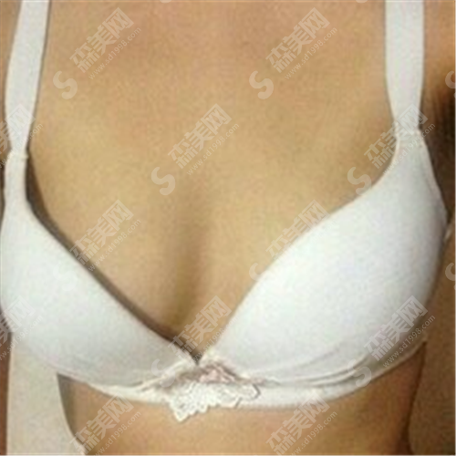 沈阳金皇后丰胸手术怎么样?医生团队如何?这里做丰胸可靠吗?