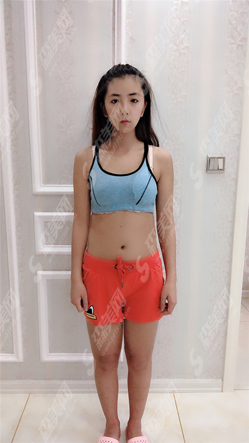 浙一医院范希玲好吗?在这里做吸脂减肥果怎么样?