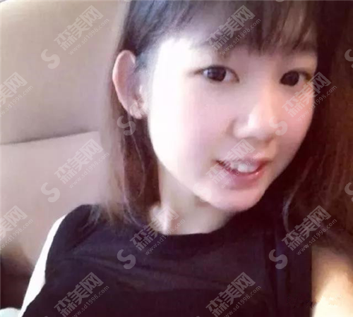 西京医院矫正牙齿大概多少钱?过程怎么样?果好吗?