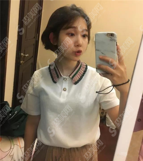 西京医院矫正牙齿大概多少钱?过程怎么样?果好吗?