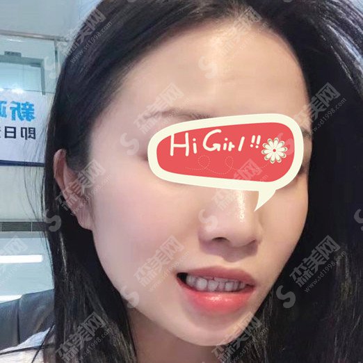 石家庄中诺口腔医院靠谱吗?牙齿矫正好嘛?真实案例参考