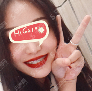 北京牙管家口腔医院怎么样?金属托槽的矫正治疗怎么样?案例分享