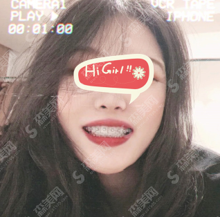 北京牙管家口腔医院怎么样?金属托槽的矫正治疗怎么样?案例分享