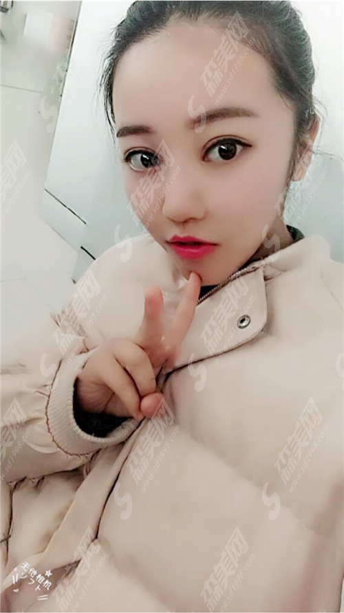 北京哪个医院割双眼皮好?如何选择医院?双眼皮术后果好吗?