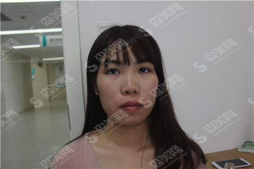 合肥壹加壹整形医院值得选择吗?真实案例告诉你果如何?