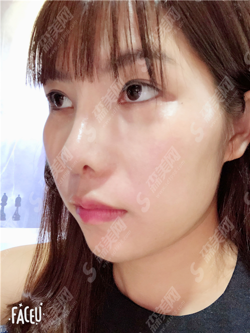 合肥壹加壹整形医院值得选择吗?真实案例告诉你果如何?