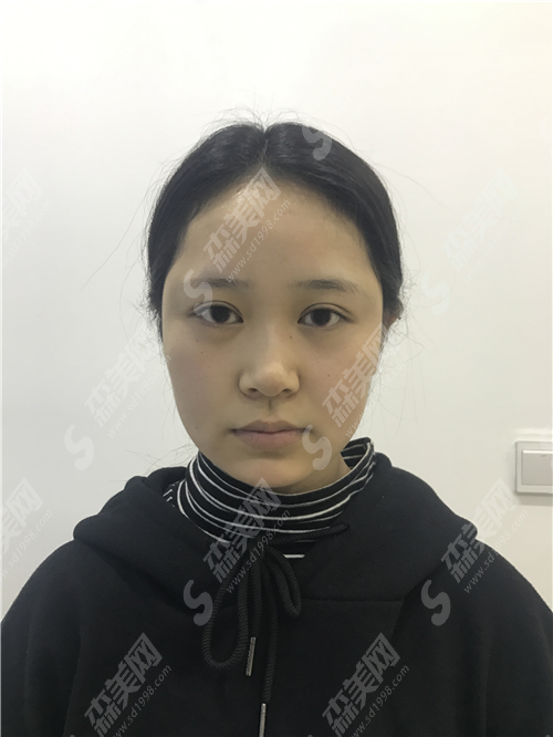 上海悦丽医疗美容整形医院怎么样?哪位医生比较好?有成功案例吗?