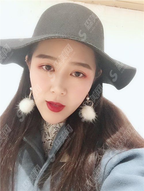 上海悦丽医疗美容整形医院怎么样?哪位医生比较好?有成功案例吗?