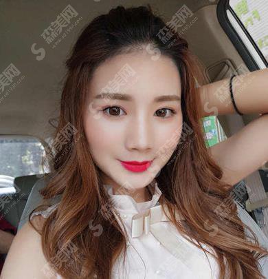 北京八大处面部脂肪填充的果好吗？案例分享及价格收费不要错过！