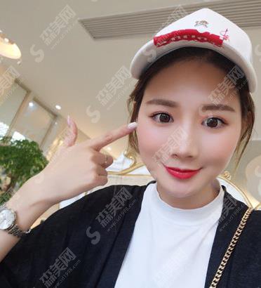 北京八大处面部脂肪填充的果好吗？案例分享及价格收费不要错过！