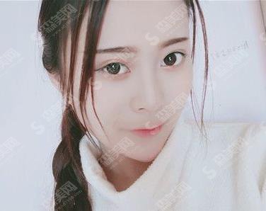 上海美联臣肋软骨隆鼻价格一览表,在分享整形案例果浏览