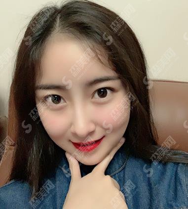 深圳北大脂肪填充哪个医生好？胡华新填充技术可以吗？专家简介及案例展示