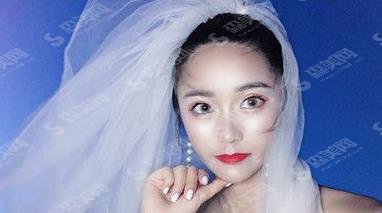 辽宁协和整形医院靠谱吗?眼部手术案例反馈+眼部整形价格收费标准